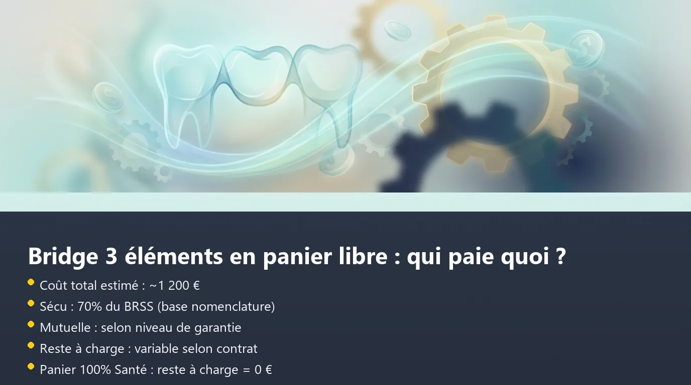 Infographie de la décomposition du remboursement d'un bridge dentaire entre Sécurité sociale, mutuelle et reste à charge